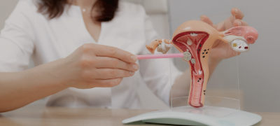 The Role of Minimally Invasive Surgery in Treating Endometriosis and Fibroids