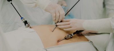 Understanding Minimally Invasive Surgery: Benefits and What to Expect